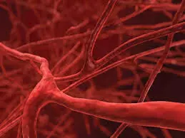 What clean blood vessels - Dr Uyigue