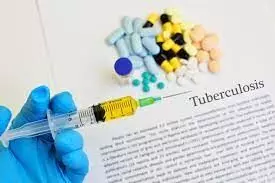 TB burden high in Nigeria, agency says