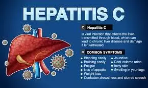 Don’t neglect signs of Hepatitis C, expert advises Nigerians