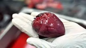 Lagos signs organ transplantation bill, 4 others