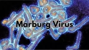 8 killed in suspected Marburg virus disease outbreak in Tanzania-WHO